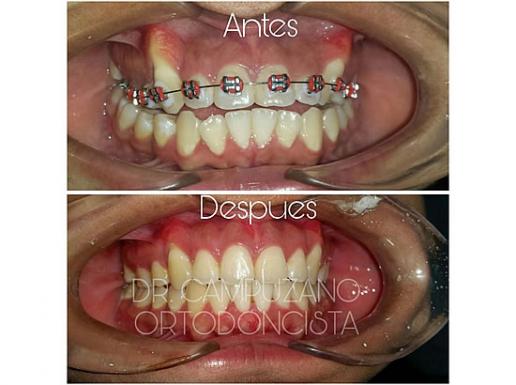 ORTODONCIA ESPECIALIZADA boliviaentusmanos